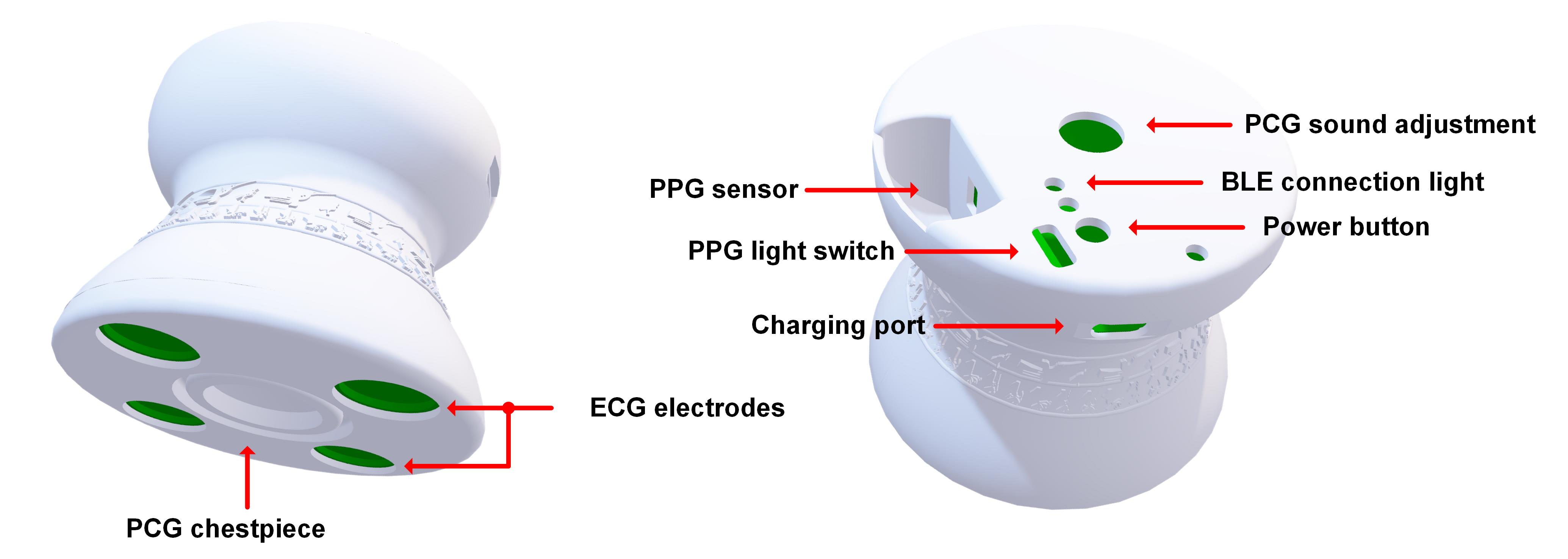 Ống nghe điện tử số ghi đồng thời PCG, PPG, ECG